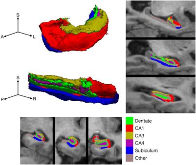 A Key Role for Subiculum-Fornix Connectivity in Recollection in Older Age